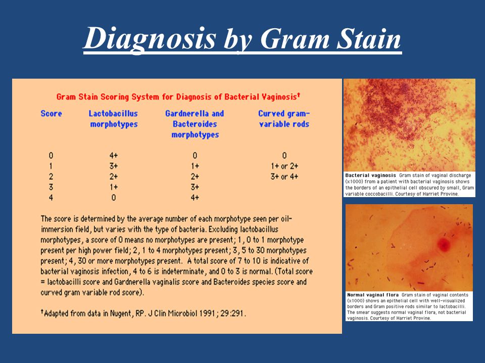 Bacterial Vaginosis Pics Porn Sex Photos